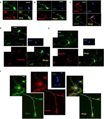 Distribution of Acid Sensing Ion Channels in Axonal Growth Cones and <mark class="highlighted">Presynaptic Membrane</mark> of Cultured Hippocampal Neurons